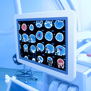 Medical Imaging（Artificial Intelligence）