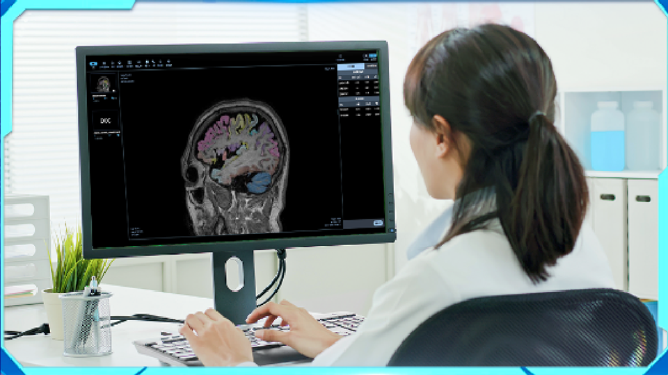 Alzheimer's Disease Magnetic Resonance Imaging Aided Diagnosis Software