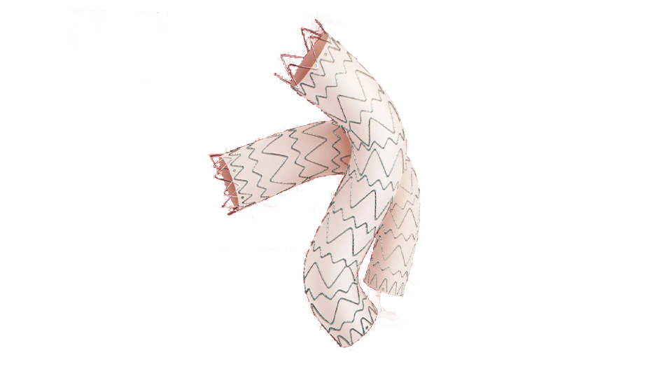 Thoracic Aortic Stent Graft System