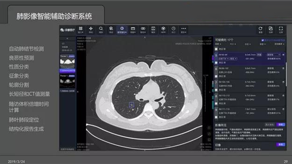 Lung Nodule Assisted Diagnosis Software