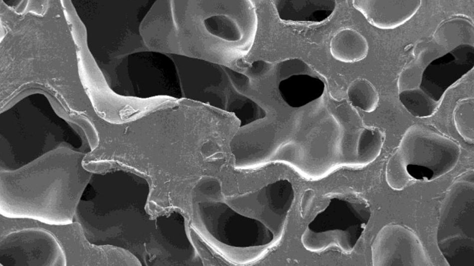 Porous Bone Repair Materials