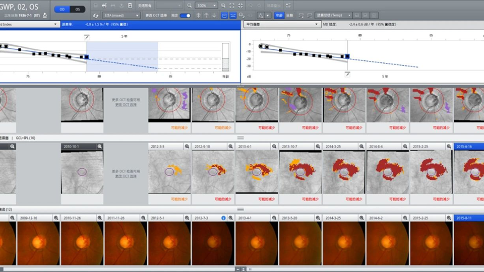 Intelligent Diagnostic Software for Ophthalmology Imaging