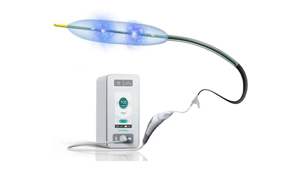 Shockwave Peripheral Intravascular Lithotripsy (IVL) Catheter 