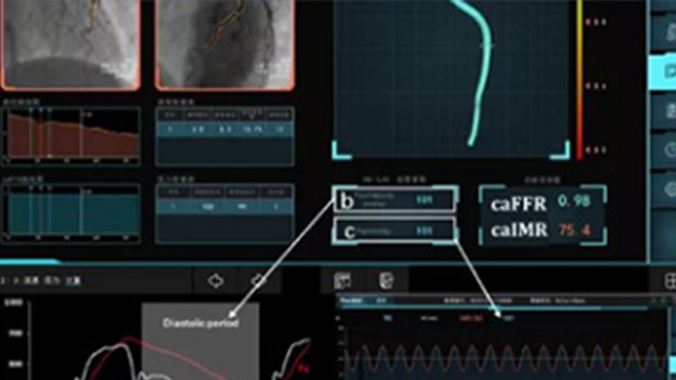 Coronary Flow Reserve Fraction Measurement System